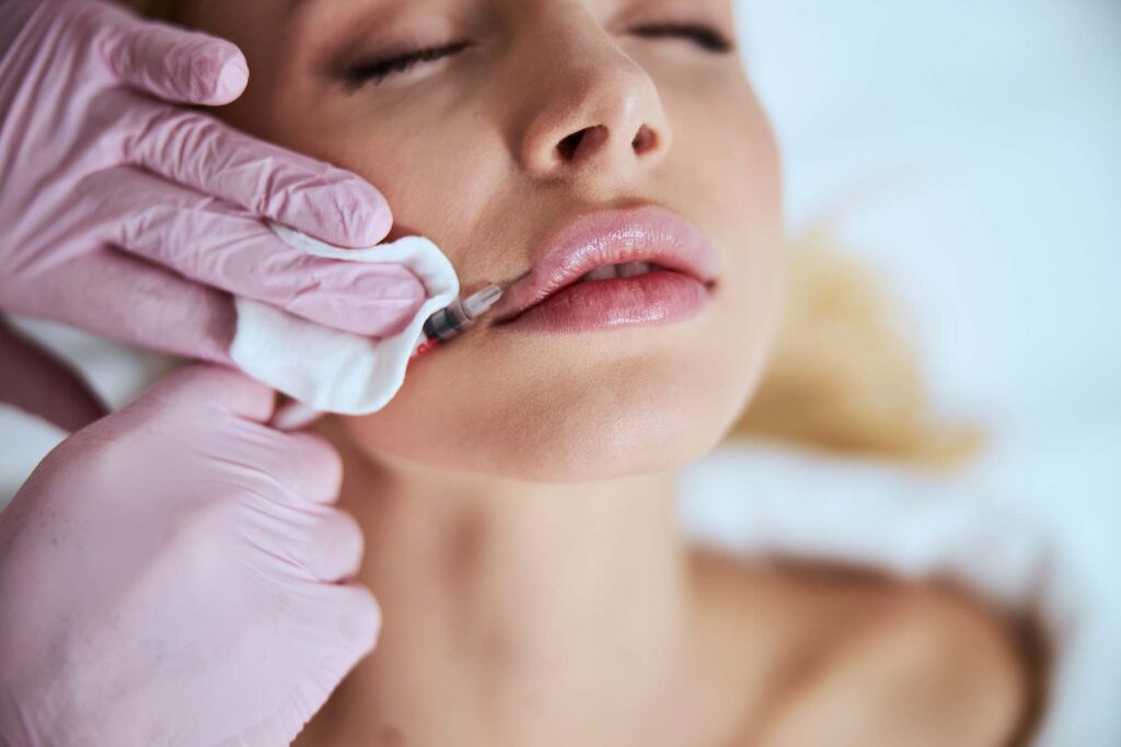 Female patient undergoing the lip enhancement procedure (dermal fillers)